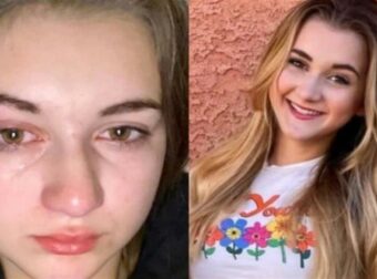 «Υποφέρω στο ντους και νιώθω τα δάκρυα μου σαν οξύ»: 15χρονη με αλλεργία στο νερό περιγράφει την καθημερινότητά της και συγκλονίζει