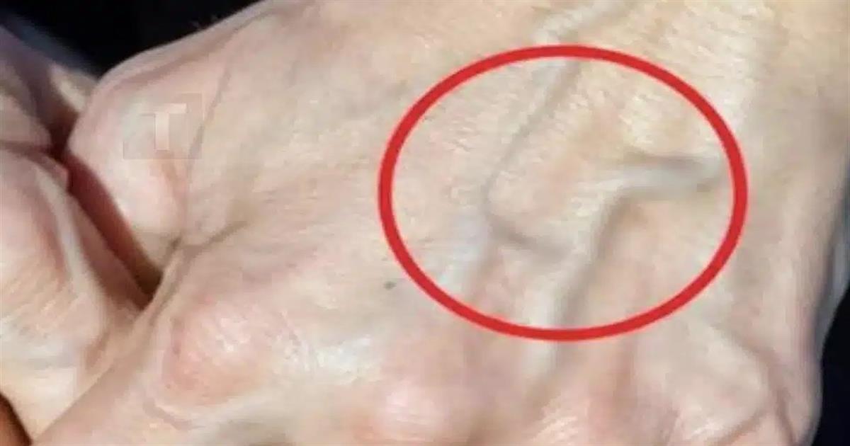 Αν έχετε ορατές φλέβες σημαίνει ότι είστε…