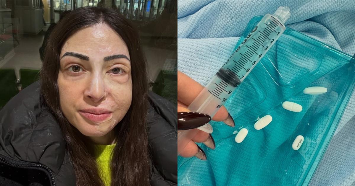 Παλιοσπύρου: Φωτογραφίες & βίντεο από τον δύσκολο αγώνα της αποθεραπείας – «Με ρωτάς πως αντέχω…»