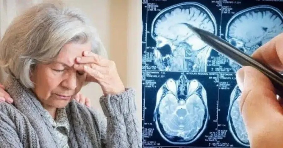 Την παίρνουν χιλιάδες Έλληνες: Η βιταμίνη που προστατεύει τον εγκέφαλο από την άνοια