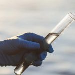 Συναγερμός στις παραλίες – Αν έχεις ανοιχτή πληγή μην βουτήξεις!: Επικίνδυνο «σαρκοφάγο βακτήριο» κρύβεται στην άμμο και εξαπλώνεται λόγω καύσωνα