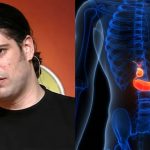 Με αφορμή τον θάνατο του Λορέντζο Καριέρε: Οι 7 ύπουλες ενδείξεις του καρκίνου στο πάγκρεας που πολλοί αγνοούν