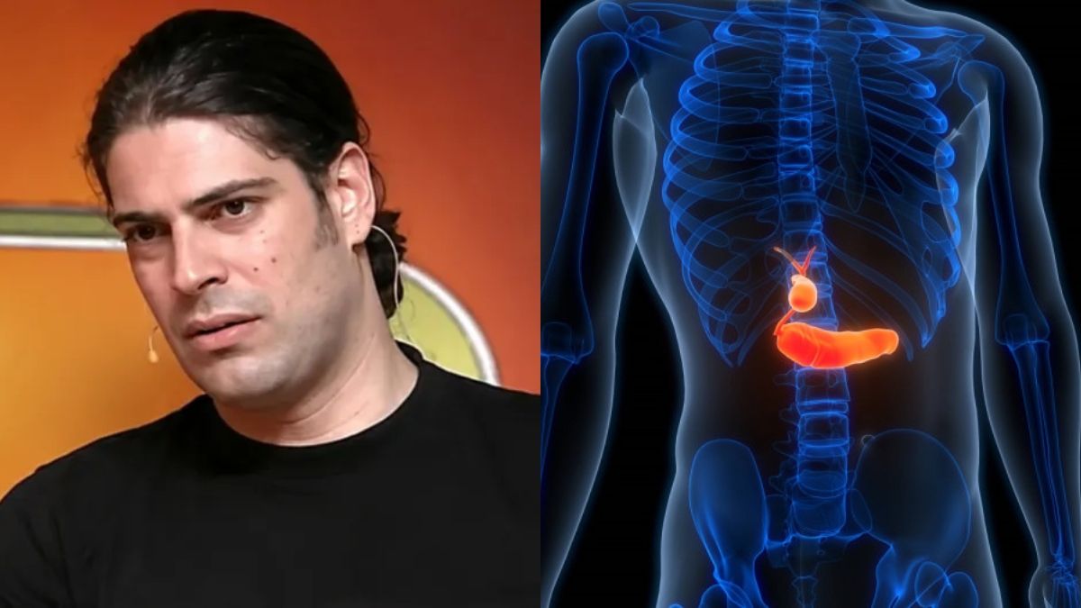 Με αφορμή τον θάνατο του Λορέντζο Καριέρε: Οι 7 ύπουλες ενδείξεις του καρκίνου στο πάγκρεας που πολλοί αγνοούν