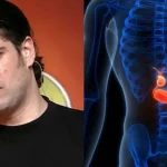 Με αφορμή τον θάνατο του Λορέντζο Καριέρε: Οι 7 ενδείξεις του καρκίνου στο πάγκρεας