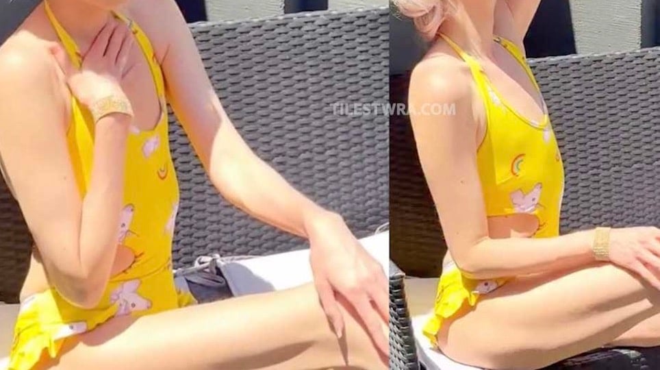 Ανησυχία για πασίγνωστη καλλονή Ελληνίδα - Η νέα εμφάνιση που ανησύχησε
