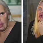 Έχει ξοδέψει 76.000 δολάρια για να γίνει έτσι! Πρέπει να δείτε πως ήταν πριν από τις επεμβάσεις
