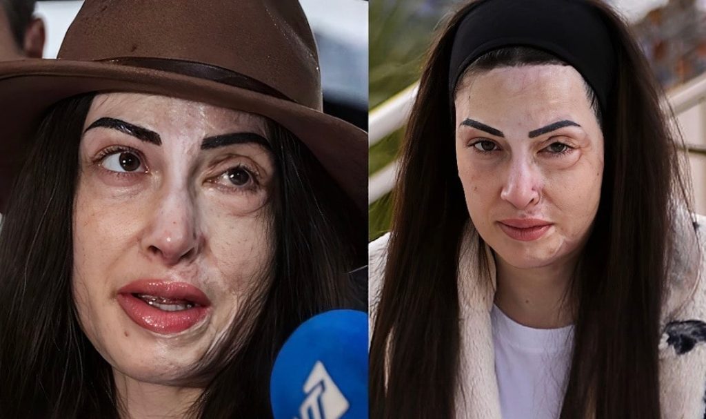 Σοκάρει το απαράδεκτο μήνυμα που έλαβε η Ιωάννα Παλιοσπύρου για βιτριόλι – Η αποστομωτική της απάντηση