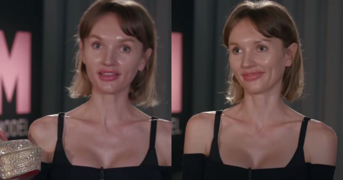GNTM: Αγνώριστη η υποψήφια που απορρίφθηκε λόγω ηλικίας – Συνέχισε τις πλαστικές και μοιάζει πλέον 16χρονη