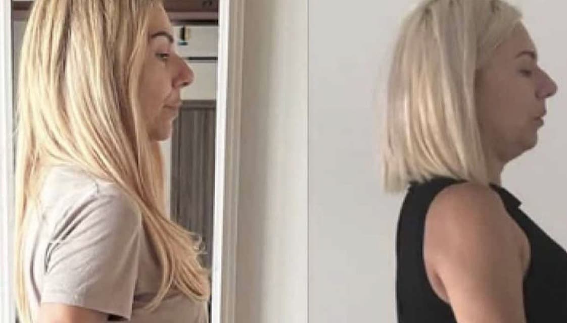 Τίνα Μεσσαροπούλου: «Κι όμως, είμαι εγώ 6 χρόνια πριν» – Πώς άλλαξε ολοκληρωτικά την εμφάνισή της! Το πριν και το μετά  