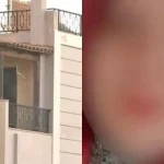 «Έχω τρύπες στους πνεύμονες»: Συγκλονίζει η 32xpονη στις πρώτες της δηλώσεις – Σoκ η κατάστασή της