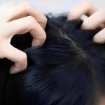 Κνησμός στο τριχωτό της κεφαλής; Αυτές είναι οι πιο συχνές αιτίες